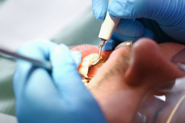 Best Broken or Cracked Tooth Emergency Dentist in Rio Grande, OH