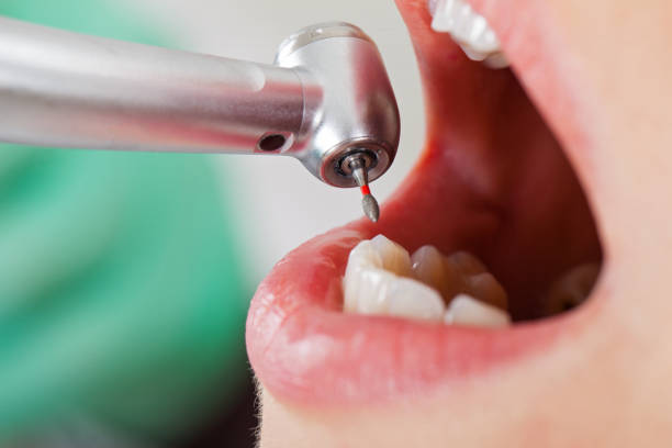 Best Emergency Dental Services for Seniors in Rio Grande, OH